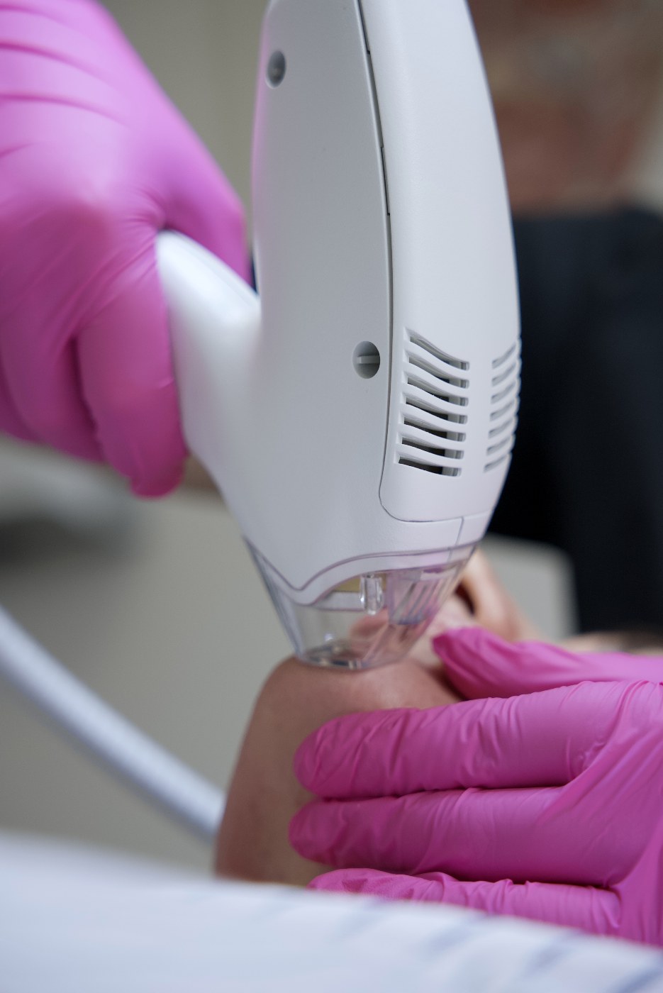 Novoxel Tixel C - system frakcyjnego odmładzania twarzy/ jak laser co2 - 2025 gwarancja — zdjęcie 4